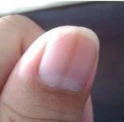 吃手指甲的危害视频,健康警示与预防措施